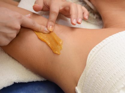 Sugaring: epilation with liquate sugar at armpit.